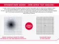 Test Amslera pokazuje zniekształcone linie, sugerując zmiany w plamce żółtej. Domowe sposoby mogą pomóc, ale konsultacja z lekarzem jest kluczowa.
