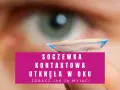 Soczewka kontaktowa utknęła w oku. Zobacz, jak ją wyjąć, gdy nie możesz jej zdjąć.