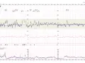 Wynik badania KTG: tętno płodu (FHR), tętno matki (MHR), ruchy płodu (FMP) i skurcze macicy (TOCO).