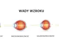 Krótkowzroczność a dalekowzroczność: Rozróżnij wady i zobacz lepiej!