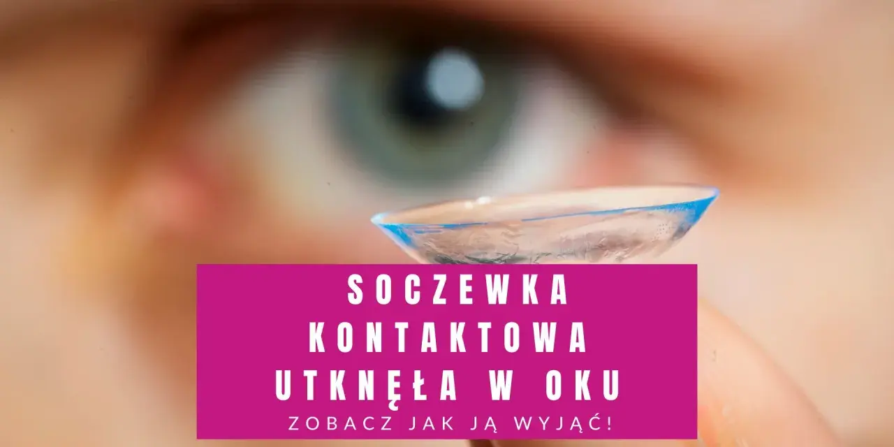 Soczewka kontaktowa utknęła w oku. Zobacz, jak ją wyjąć, gdy nie możesz jej zdjąć.