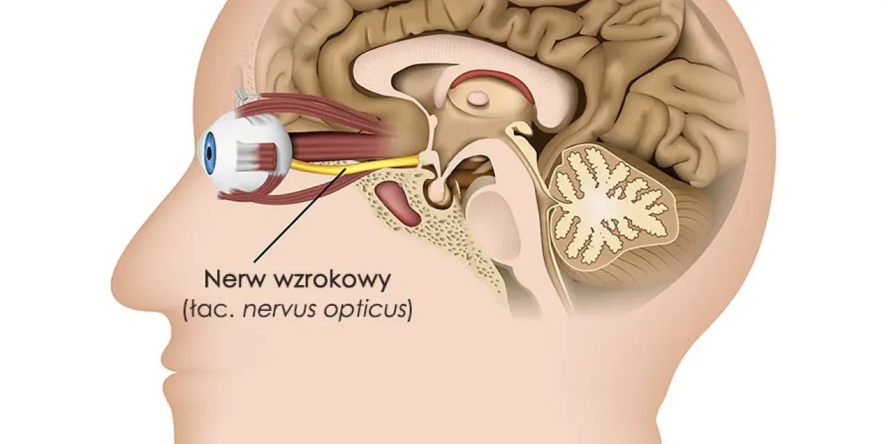 Przekrój głowy ukazujący oko i nerw wzrokowy. Obrzęk tarczy nerwu wzrokowego objawy mogą być widoczne w tej okolicy.