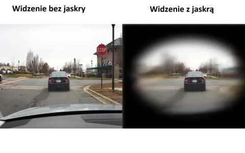 Porównanie widzenia: po lewej normalne, po prawej z jaskrą, gdzie centralne pole widzenia jest zamazane.