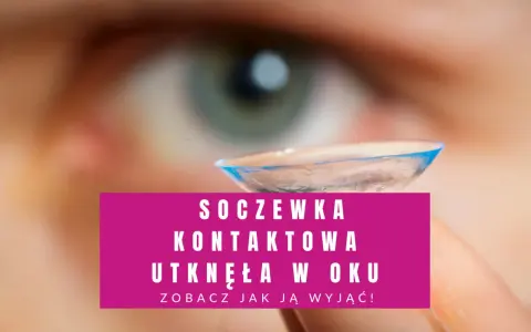 Soczewka kontaktowa utknęła w oku. Zobacz, jak ją wyjąć, gdy nie możesz jej zdjąć.