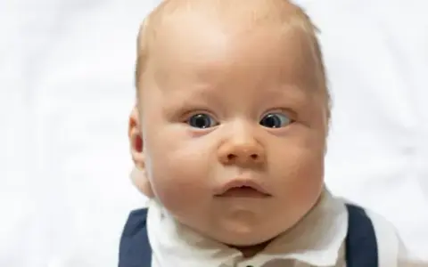 Zez u niemowlaka: Kiedy to norma, a kiedy pilna wizyta u okulisty?