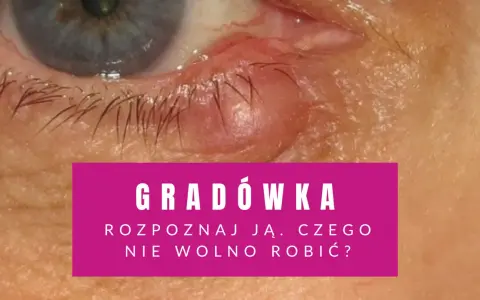 Widoczna gradówka wewnątrz powieki, czerwona i opuchnięta. Tekst informuje o rozpoznawaniu i postępowaniu.