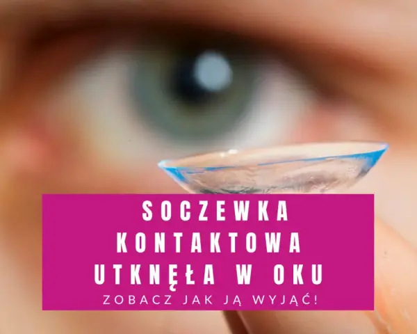 Soczewka kontaktowa utknęła w oku. Zobacz, jak ją wyjąć, gdy nie możesz jej zdjąć.