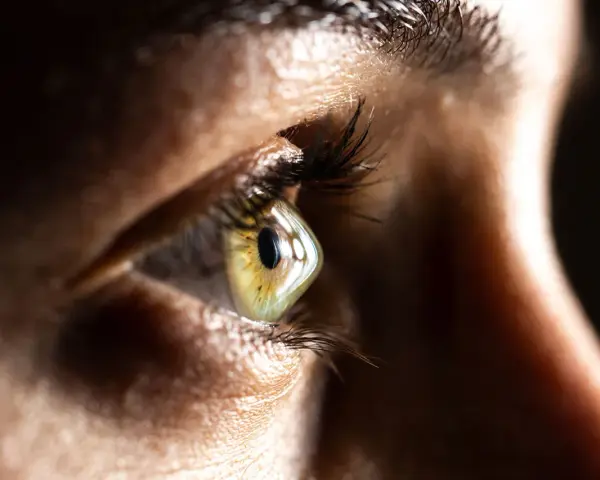 Zbliżenie oka z widocznym zmętnieniem rogówki. Tęczówka w odcieniach zieleni i brązu, otoczona ciemnymi rzęsami.