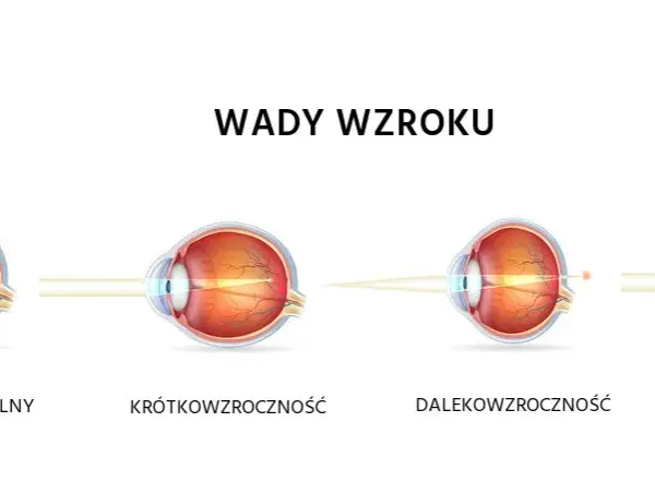 Krótkowzroczność a dalekowzroczność: Rozróżnij wady i zobacz lepiej!