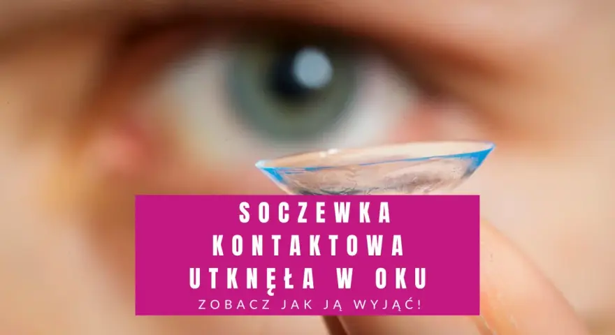 Soczewka kontaktowa utknęła w oku. Zobacz, jak ją wyjąć, gdy nie możesz jej zdjąć.