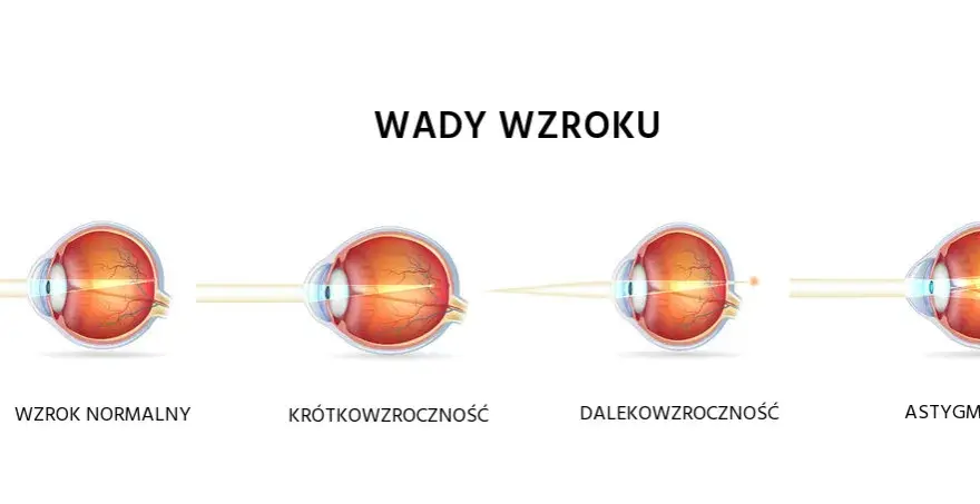 Krótkowzroczność a dalekowzroczność: Rozróżnij wady i zobacz lepiej!