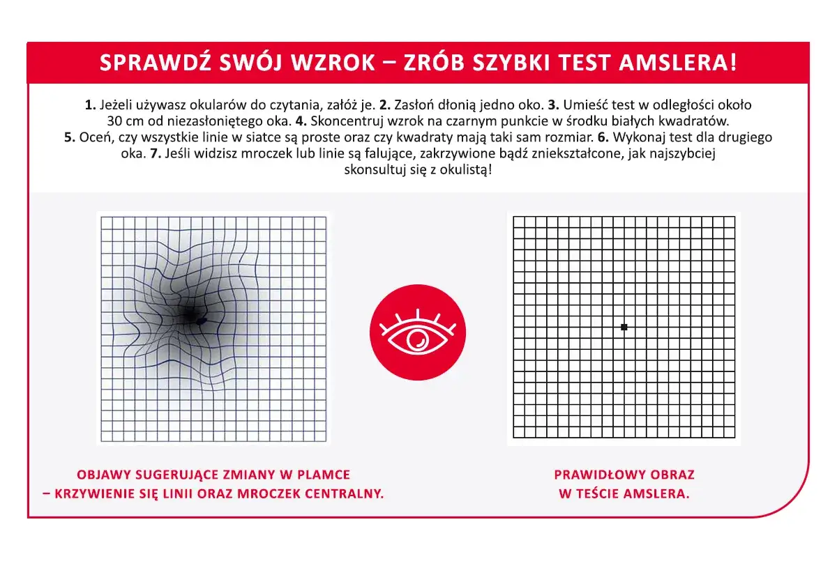 Test Amslera pokazuje zniekształcone linie, sugerując zmiany w plamce żółtej. Domowe sposoby mogą pomóc w profilaktyce.